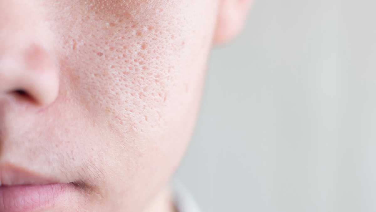 Comment fermer les pores de votre visage en quelques minutes seulement ?