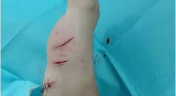 Des touristes jettent de la nourriture dans la mer, 3 requins attaquent un garçon aux Bahamas