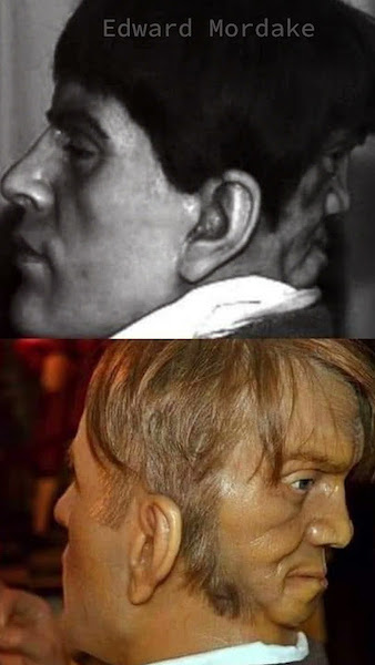 L'histoire d'Edward Mordrake, l'homme aux deux visages