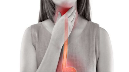 Cancer de l'œsophage - Symptômes et causes