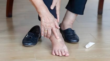 Les meilleurs remèdes maison pour soulager les pieds gonflés
