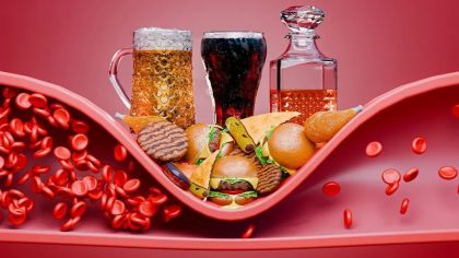 Comment nettoyer vos artères : conseils pour un cœur en bonne santé