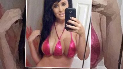 Est-il possible pour une femme d'avoir trois seins, que ce soit à la suite d'une malformation mammaire ou d'une opération de chirurgie esthétique ?