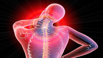 Fibromyalgie : symptômes, causes et diagnostic