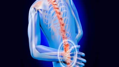 La Spondylarthrite Ankylosante une maladie de douleurs et d'incompréhensions