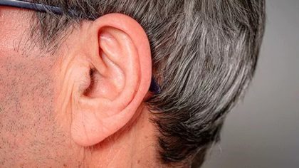 Pourquoi des poils apparaissent dans l’oreille ?