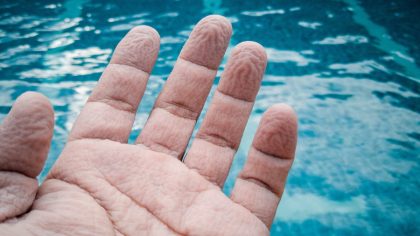 Pourquoi nos doigts se froissent-ils lorsqu’ils passent beaucoup de temps en contact avec l’eau ?