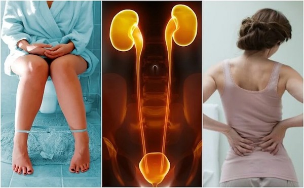 10 signes que vos reins s'affaiblissent et qu'ils ont besoin d'aide