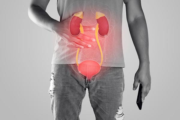 5 symptômes du cancer de la vessie qui sont confondus avec une infection des voies urinaires