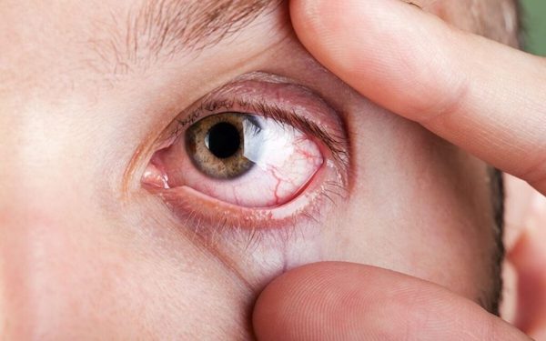 7 signes dans vos yeux qui indiquent un problème de santé