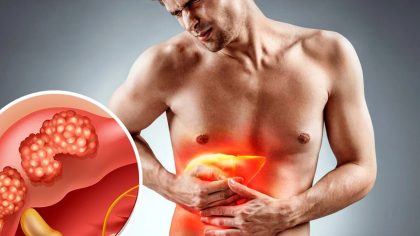 8 signes silencieux du cancer du foie que tout le monde ignore