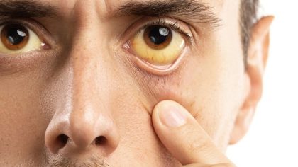 7 signes dans vos yeux qui indiquent un problème de santé