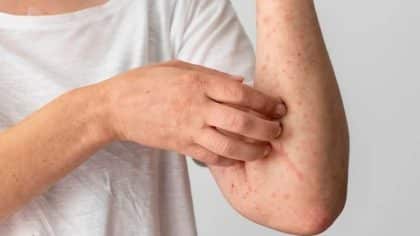 Leucémie : causes, traitement et signes précoces