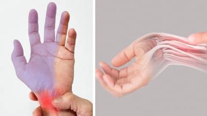 Quelles sont les causes des picotements dans les mains et quand faut-il consulter un médecin ?