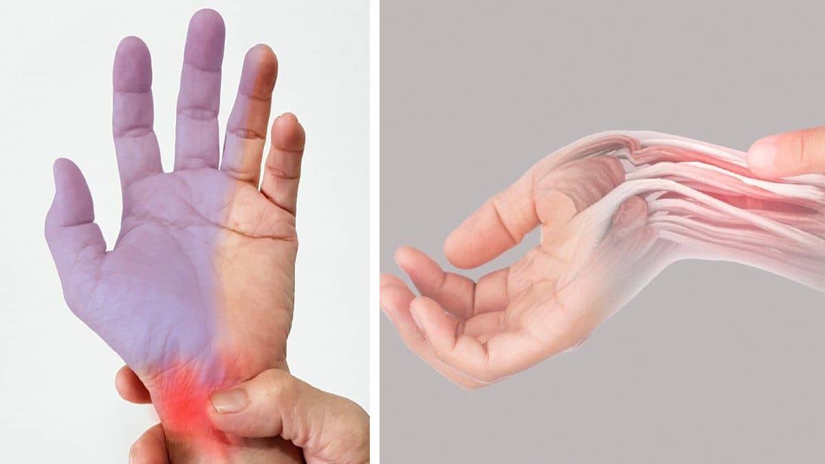 Quelles sont les causes des picotements dans les mains et quand faut-il consulter un médecin ?