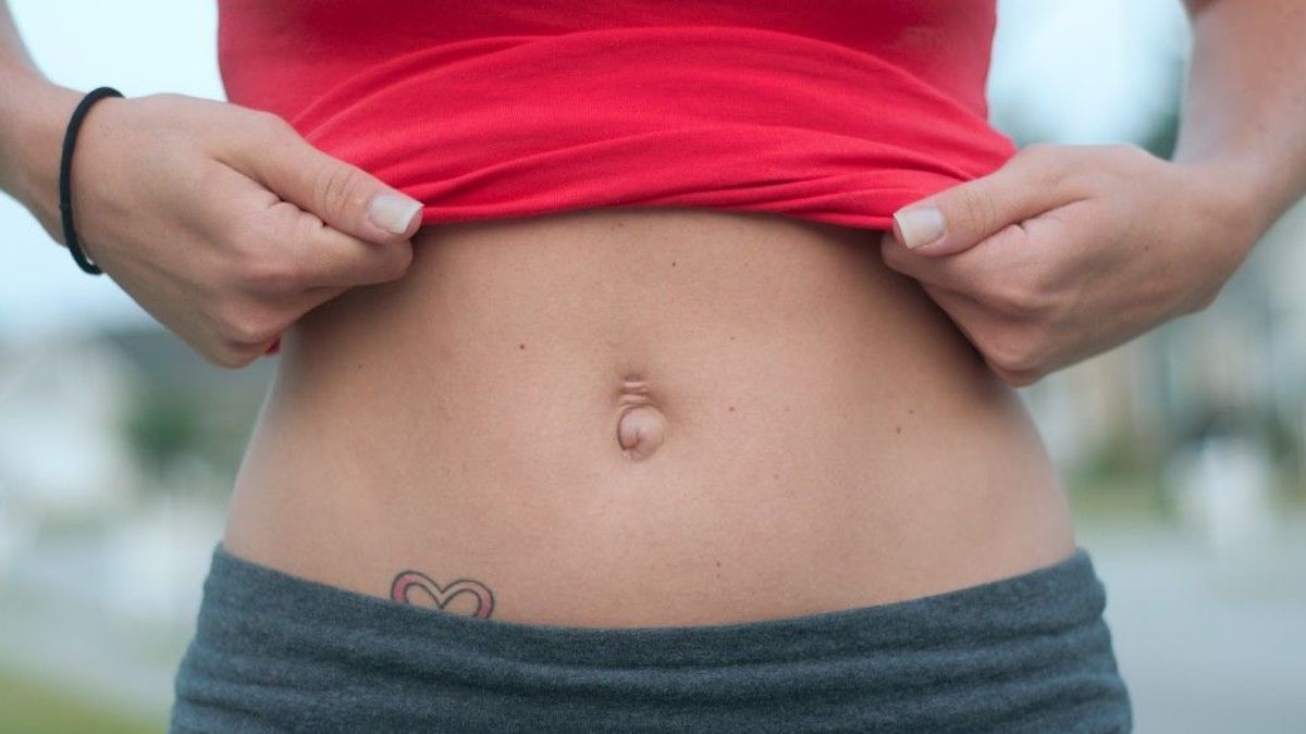 Hernie ombilicale : causes, symptômes, complications et traitement