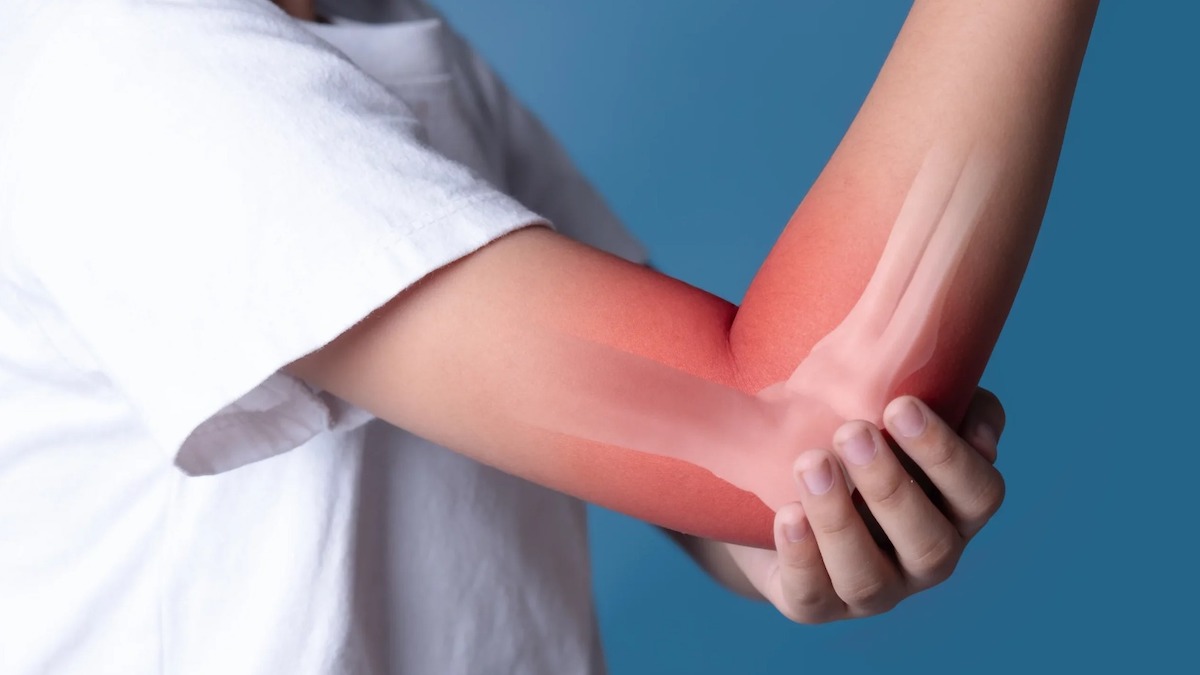 Cancer des os : symptômes et causes