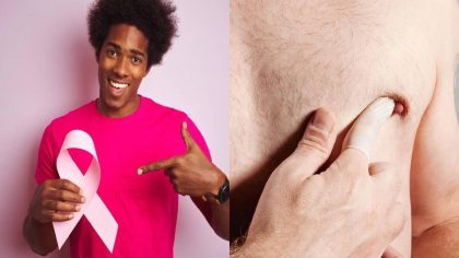 Cancer du sein chez l'homme : symptômes