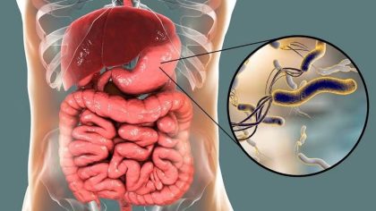 Comment se transmet la bactérie liée au cancer de l'estomac