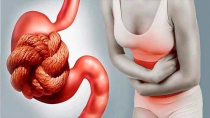 Constipation : symptômes, diagnostic et traitement