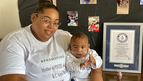 Curtis, le bébé le plus prématuré du monde : né aux États-Unis à 21 semaines de grossesse, pesant 420 grammes