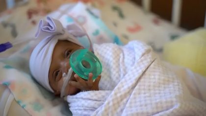 Le plus petit bébé prématuré du monde, pesant 245 grammes, survit