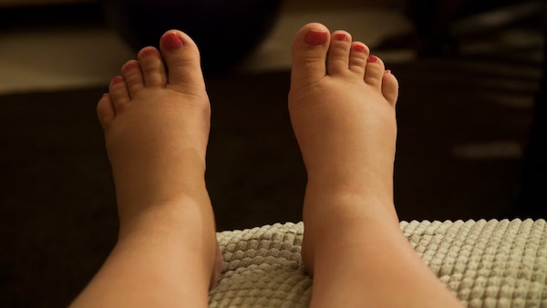 Pourquoi les pieds gonflent-ils et comment traiter cette affection ?