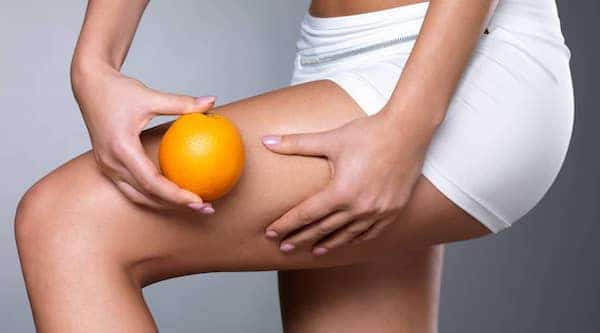 Qu'est-ce que la peau d'orange ? Tout ce que vous devez savoir sur la cellulite