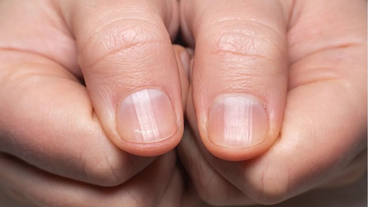 Savez-vous ce que signifie la « demi-lune » sur vos ongles ? Voici ce que cela montre sur votre santé