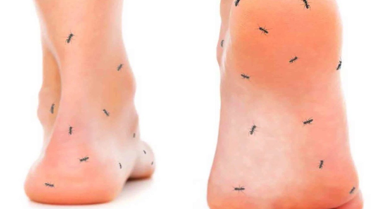 Signes sur vos pieds concernant votre santé générale