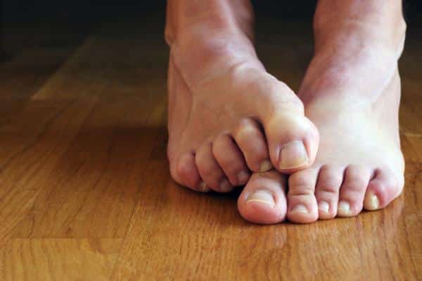 Signes sur vos pieds concernant votre santé générale