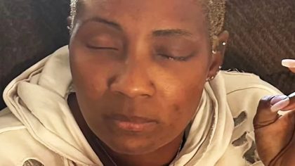 Une femme confond de la colle avec des gouttes pour les yeux et finit hospitalisée