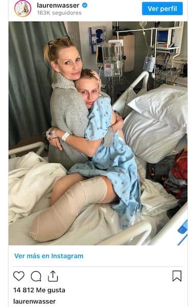 Une mannequin a perdu ses deux jambes après une infection avec un tampon et a continué sa carrière