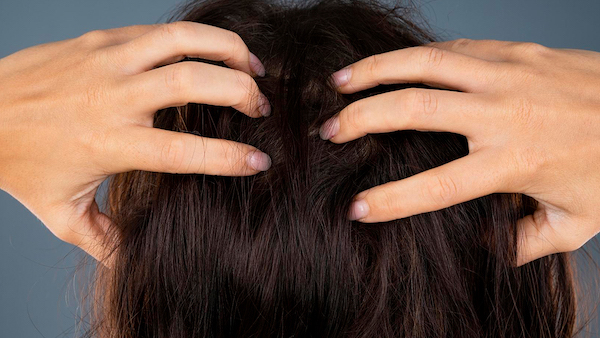 10 raisons pour lesquelles votre cuir chevelu vous démange et comment les soulager
