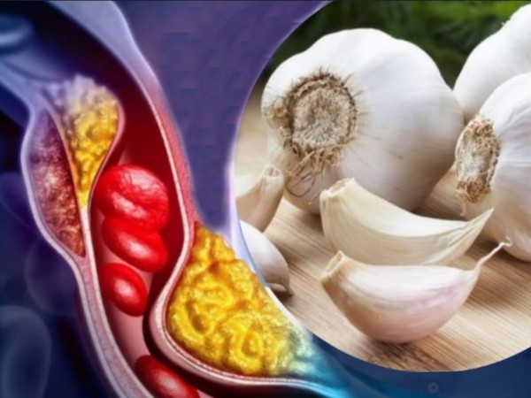 11 bienfaits prouvés de l'ail pour la santé