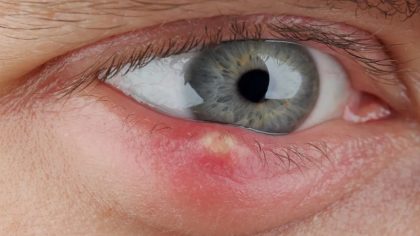 7 signes dans vos yeux qui indiquent un problème de santé