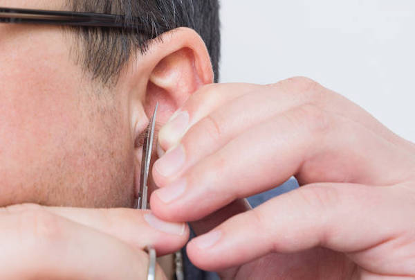 Hypertrichose auriculaire : le phénomène des poils dans les oreilles