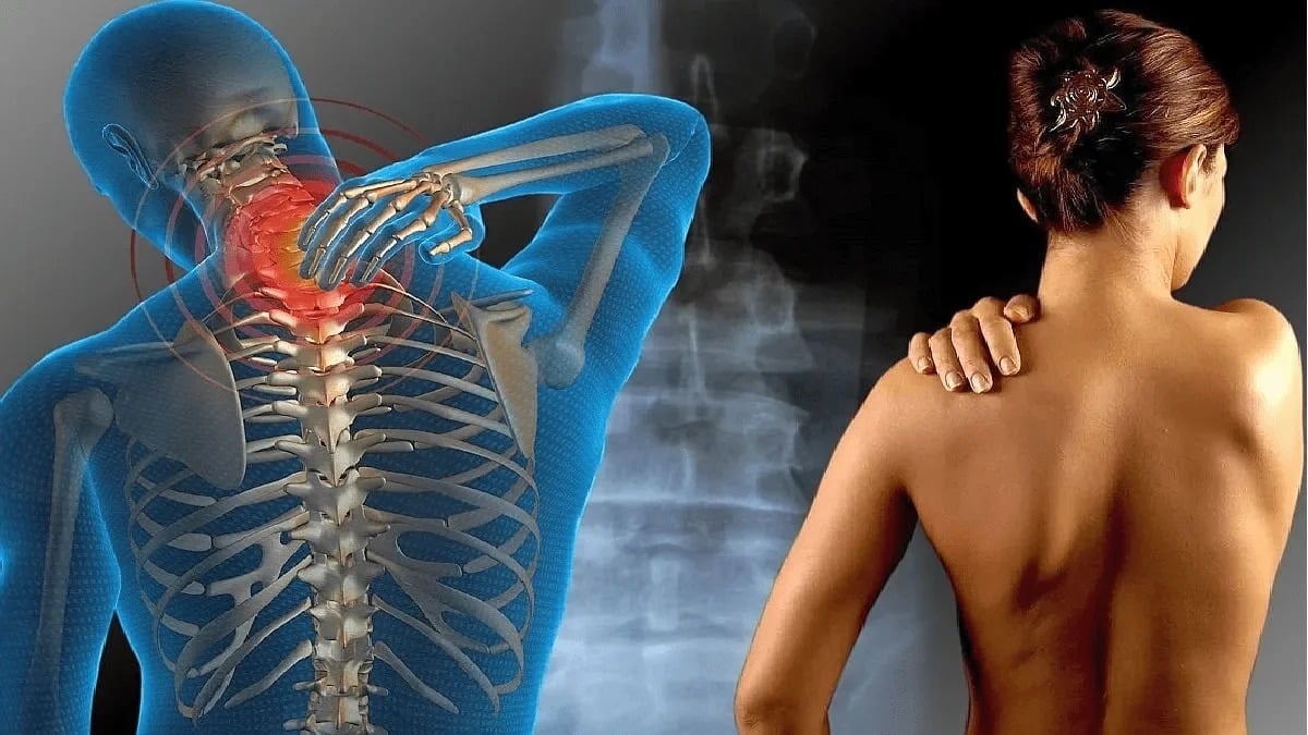 La fibromyalgie : une maladie silencieuse