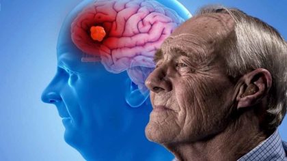 La maladie d'Alzheimer : signes précoces que l'on ignore trop souvent peuvent tout changer
