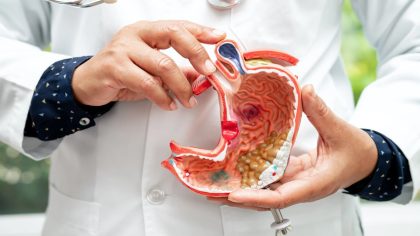 Le symptôme qui apparaît en mangeant et qui prévient du cancer de l'estomac