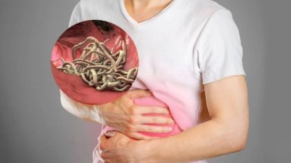 L'origan pour éliminer les parasites internes du corps