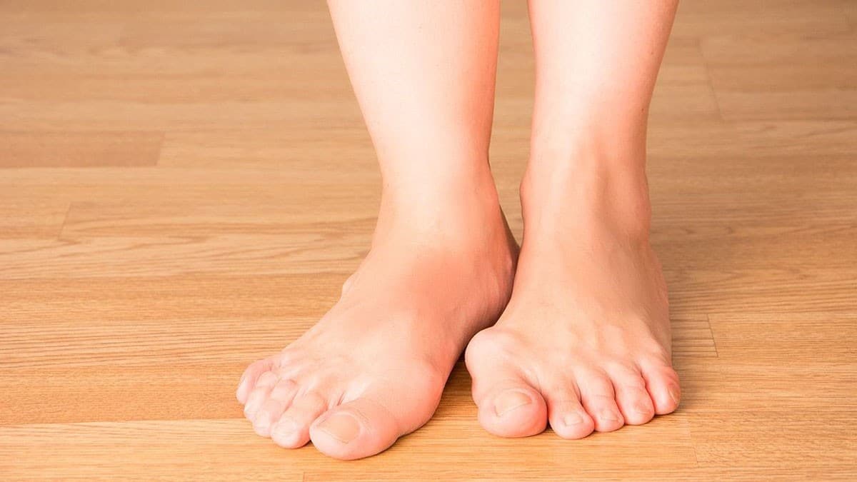Maladie de Charcot-Marie-Tooth : symptômes et causes