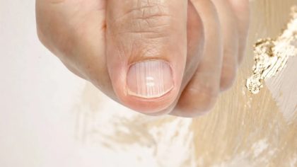 Ongles rayés : qu'est-ce que cela signifie et que pourrait dire le corps ?