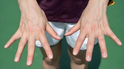 Pourquoi certaines personnes affichent des veines bien visibles