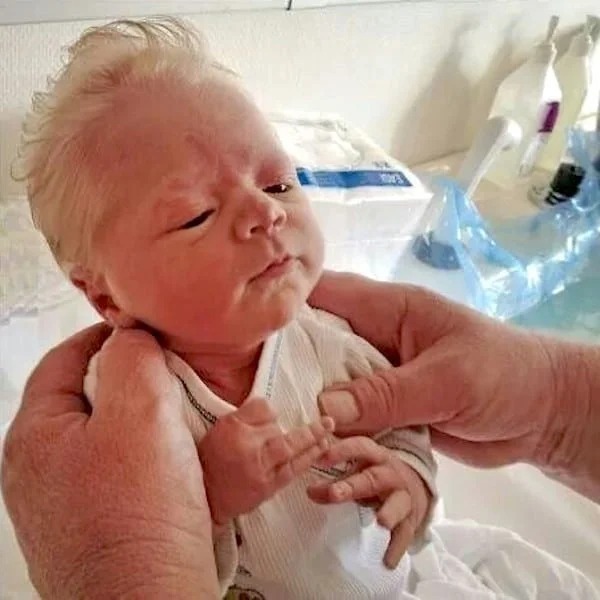 Un bébé naît avec des cheveux très blancs et émerveille toute la salle d'accouchement