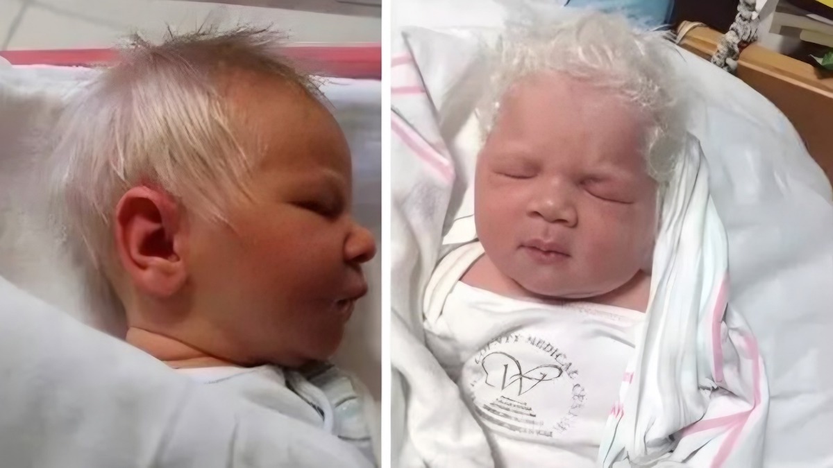 Un bébé naît avec des cheveux très blancs et émerveille toute la salle d'accouchement