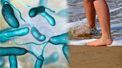 Vibrio vulnificus : infection, diagnostic et traitement