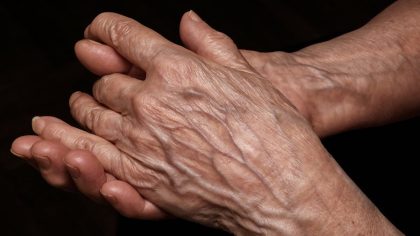 Ce que les veines visibles signifient pour votre santé