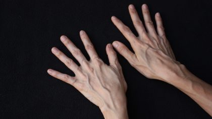Ce que les veines visibles signifient pour votre santé