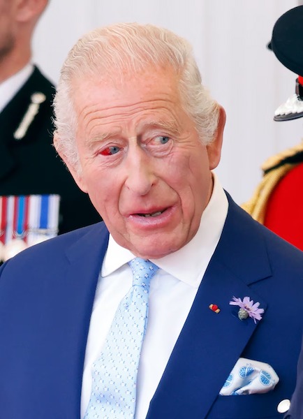 Les inquiétudes grandissent pour la santé du roi Charles III après sa rencontre avec Macron